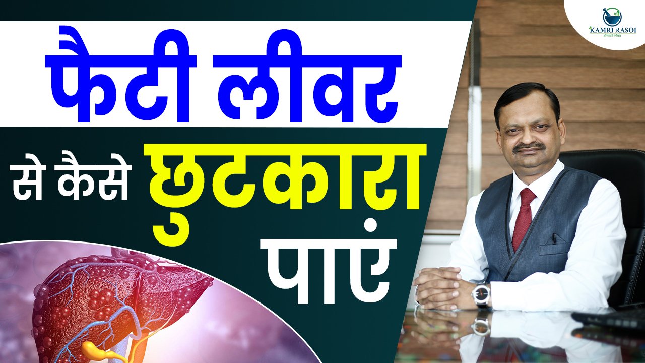 Natural Home Remedies For Fatty Liver