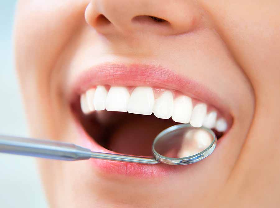 Home Remedies for Yellow Teeth