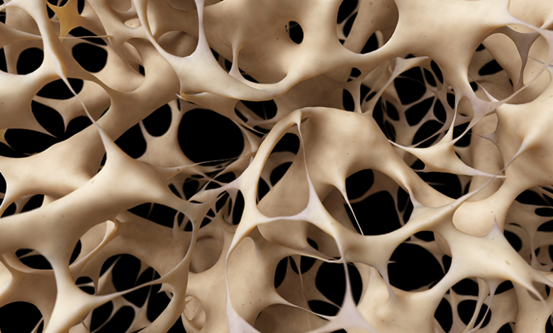 best treatment for osteoporosis
