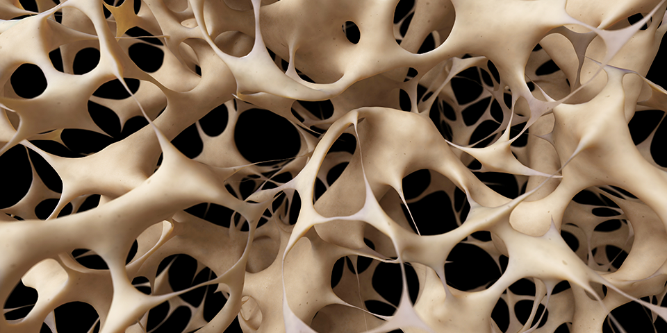 best treatment for osteoporosis
