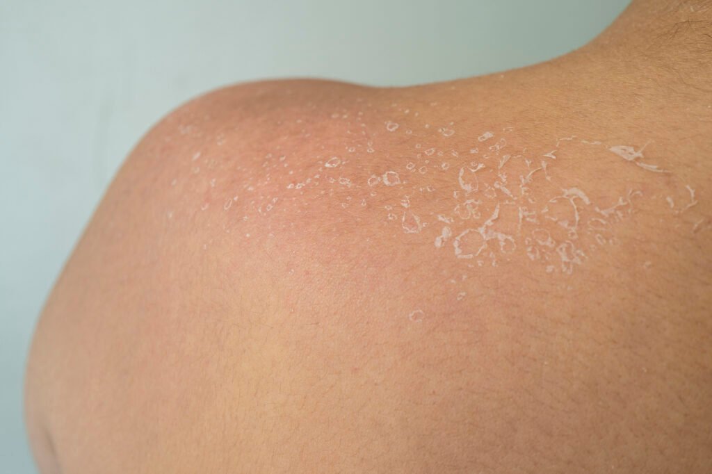 Benefits of Using Castor Oil