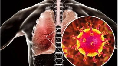 Lung Infection